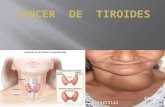 CANCER  DE  TIROIDES.pptx