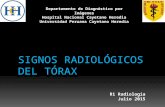 Signos Radiológicos Del Torax