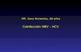 MR, Sexo femenino, 49 años Coinfección HBV – HCV