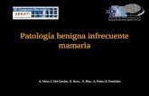 Patología benigna infrecuente mamaria A. Mesa, C. Del Camino, E. Nava, A. Díaz, A. Prieto, E. Fernández.