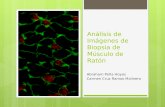Análisis de Imágenes de Biopsia de Músculo de Ratón Abraham Peña Hoyos Carmen Cruz Ramos Molinero.