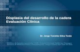 Displasia del desarrollo de la cadera Evaluación Clínica Servicio de Aparato Locomotor- DMR- Hospital Nacional Guillermo Almenara Servicio de Medicina.