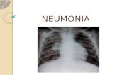 NEUMONIA. Definición La neumonía es la infección del parénquima pulmonar, con afectación de los espacios alveolares, que son ocupados por microorganismos.
