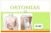 OSTOMÍAS Docente: DANIEL MELLA. ¿Qué es la ostomía? Una ostomía es una operación quirúrgica en la que se practica una abertura (estoma) en la pared abdominal.