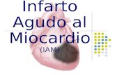 Infarto Agudo al Miocardio (IAM). Definición  Cuadro clínico que acompaña a la necrosis miocárdica, de origen isquémico.  Es urgencia médica.