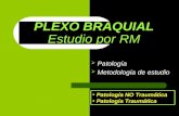 Patología  Metodología de estudio PLEXO BRAQUIAL PLEXO BRAQUIAL Estudio por RM Patología NO Traumática Patología Traumática.