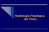 Radiología Patológica del Tórax. Radiografía de Tórax Normal