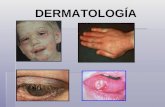 DERMATOLOGÍA. Asignatura que se encarga del estudio, prevención y tratamiento de las enfermedades de la piel mucosas y faneras, en estrecha relación con.