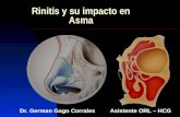 Rinitis y su impacto en Asma Dr. German Gago Corrales Asistente ORL – HCG.