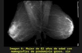 Imagen 6: Mujer de 82 años de edad con mamografías de predominio graso, sin alteraciones destacables.