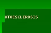 OTOESCLEROSIS. DEFINICION  OSTEODISTROFIA DE LA CAPSULA LABERINTICA.  TIPOS:FOCAL DIFUSA DIFUSA  HEREDITARIA DOMINANTE.  MUJERES 20-50 AÑOS  FACTORES