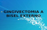 GINGIVECTOMIA A BISEL EXTERNO La gingivectomia es el procedimiento quirúrgico donde se realiza la excisión y eliminación de tejido gingival. Su finalidad.