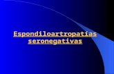 Espondiloartropatías seronegativas. 1- Espondilitis anquilosante Definición : Enfermedad del tejido conectivo caracterizado por inflamación del esqueleto.