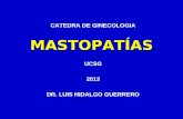 MASTOPATÍAS CATEDRA DE GINECOLOGIA UCSG 2013 DR. LUIS HIDALGO GUERRERO.