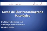 Curso de Electrocardiografía Patológico