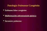 Patología Pulmonar Congénita