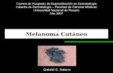 Detección precoz del Melanoma Cutáneo