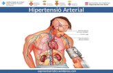 Hipertensió Arterial