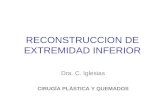 RECONSTRUCCION DE EXTREMIDAD INFERIOR