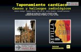 Taponamiento cardíaco Causas y hallazgos radiológicos