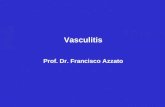 Vasculitis Prof. Dr. Francisco Azzato