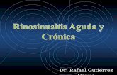 Rinosinusitis  Aguda y Crónica