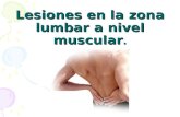 Lesiones en la zona lumbar a nivel muscular .
