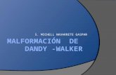 MALFORMACIÓN  DE    dandy  - walker