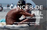 CÁNCER DE PIEL NO MELANOMA