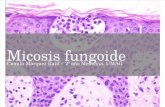 Micosis fungoide y Nefritis lúpica