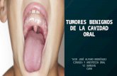 Tumores Benignos  de La Cavidad Oral