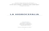 La Hidrocefalia en Niños (Tesis)
