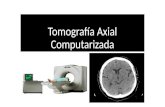 Tomografía Axial Computarizada