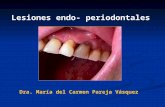 Lesiones Endoperiodontales 2012 ABRIL 13-4-12