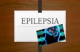 EPILEPSIA. ETIOLOGIA La epilepsia es un trastorno del sistema nervioso central, provocado por el aumento de la actividad eléctrica de las neuronas en.