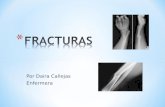 Por Daira Callejas Enfermera. * Una fractura consiste en la pérdida de continuidad del hueso.