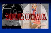 Enfermedad Vascular: Un proceso progresivo y generalizado Angina inestable SICA IM EVC/ATI isqu©mico Isquemia critica en piernas Muerte cardiovascular