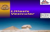 20090511 Litiasis Vesicular