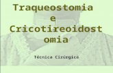 Traqueostomia e Cricotireoidostomia Técnica Cirúrgica.