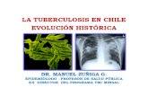 04. La Tuberculosis en Chile Ev.historica