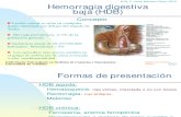 Hemorragia Digestiva Baja-2015 (1)