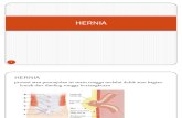 106157127 Presentasi Hernia