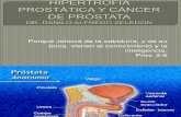 2- Hipertrofia Prostatica y CA de Prostata