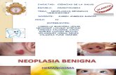 Hemangioma_patologia I_trabajo Grupal (1)