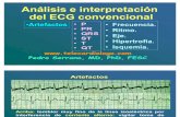 Análisis e interpretación  de EKG convencional 1