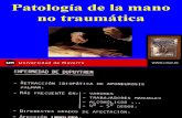 25 - patología de la mano II (no traumática)