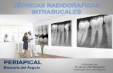 Técnica radiografica intrabucal periapical bisectriz del ángulo.