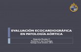 Evaluación ecocardiográfica en patología aórtica
