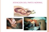Atencion del parto normal
