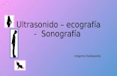 Ecografía =  ultrasonido = sonografía